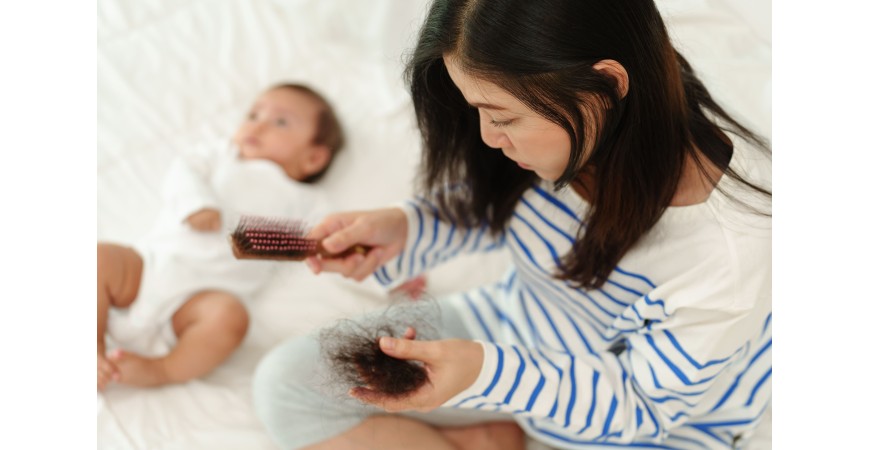 Postpartum Hair Loss Treatment