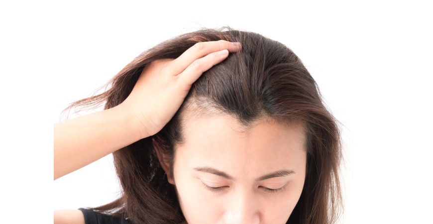 Hair Growth Treatment in Singapore 