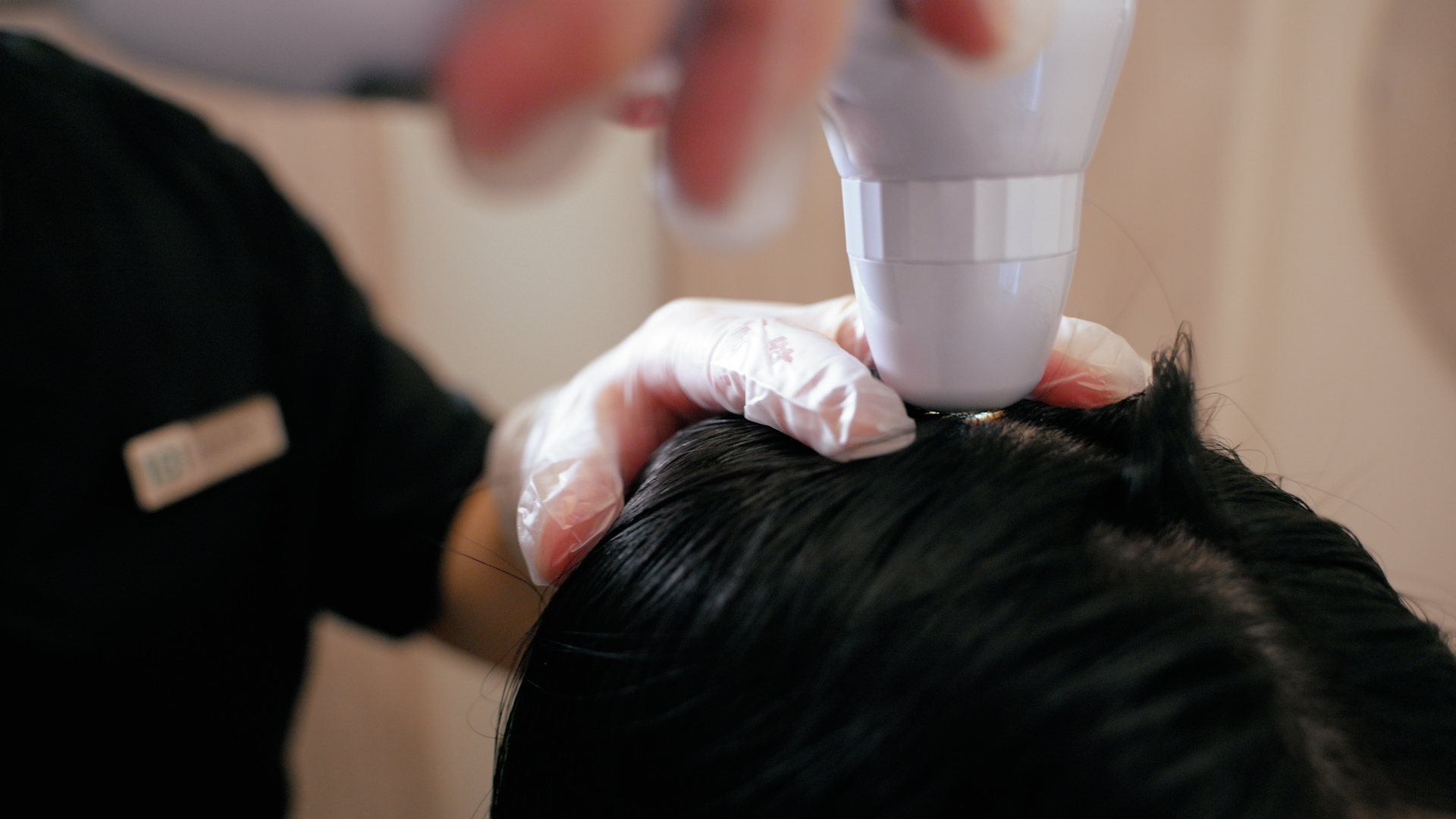 about postpartum hair loss in mothers