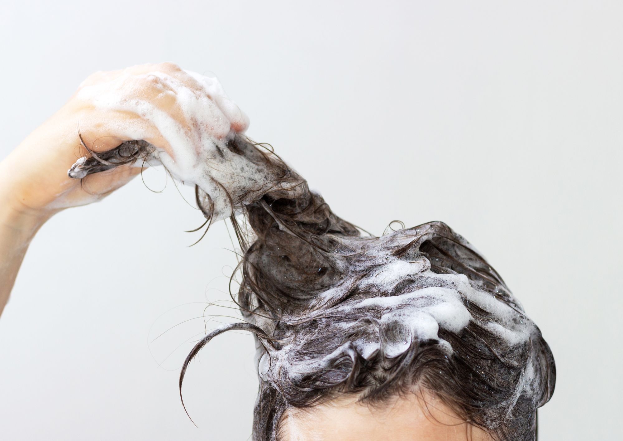 dandruff shampoos"
