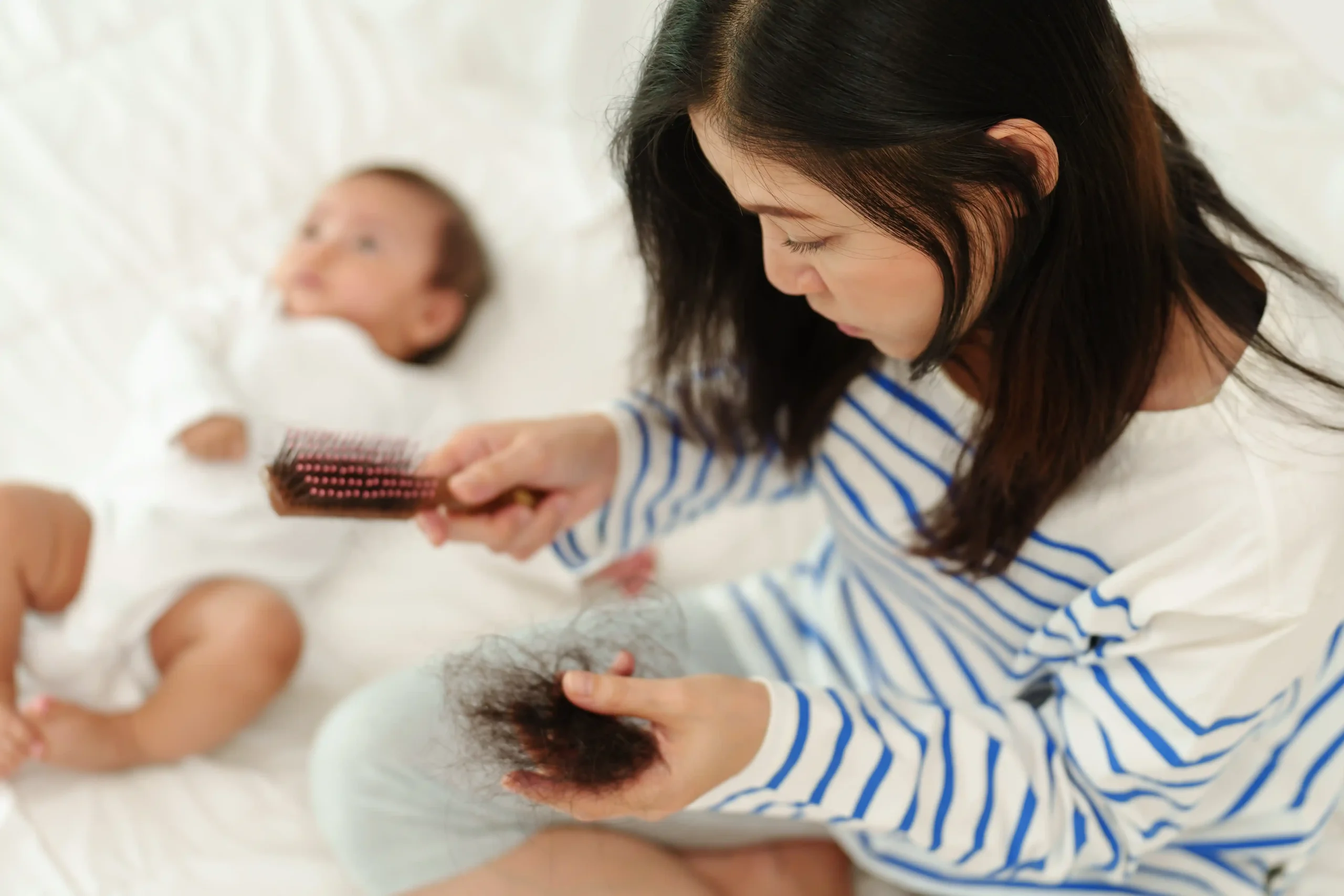 What Is Postpartum Hair Loss?