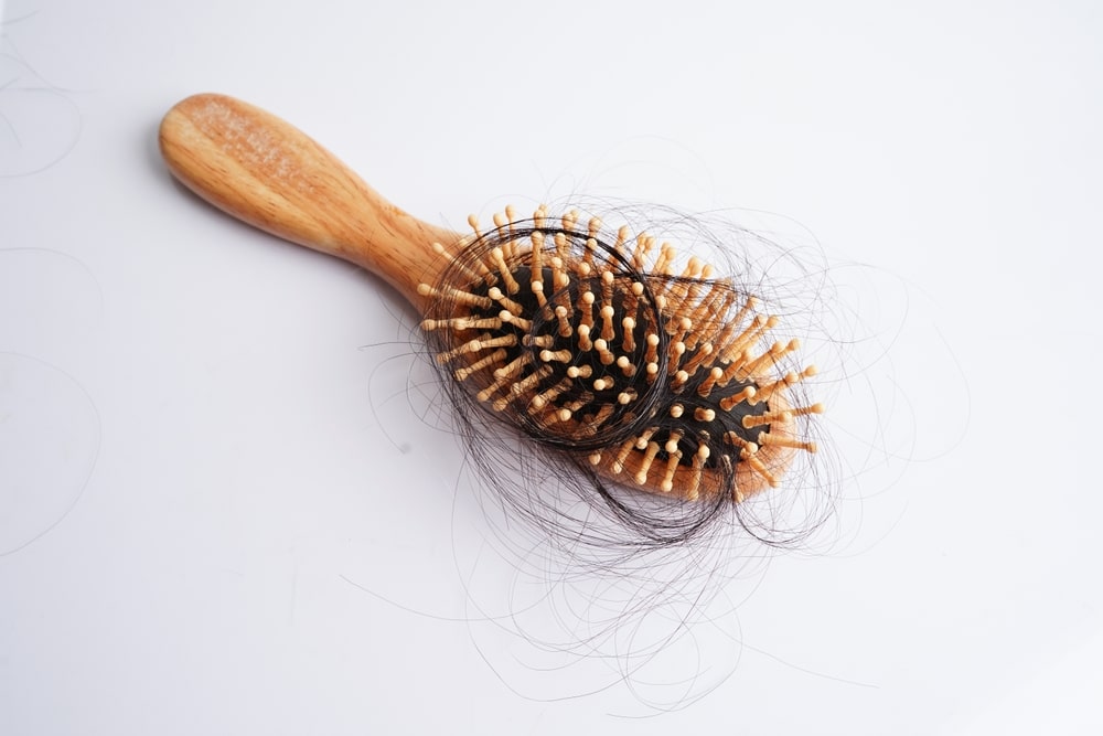 hair loss condition