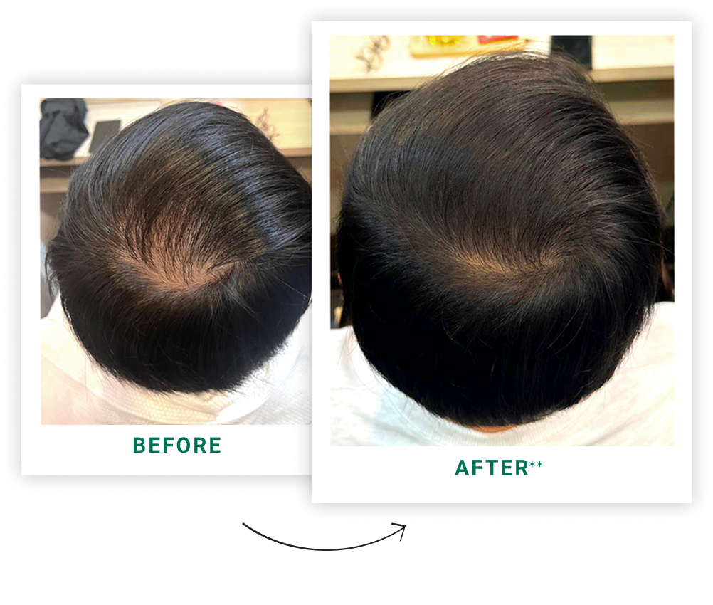 Before and After Treatment Result 1